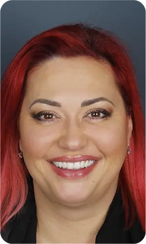 Diş Köprüsü