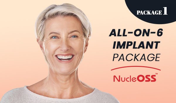 All on 6 Implant Packages