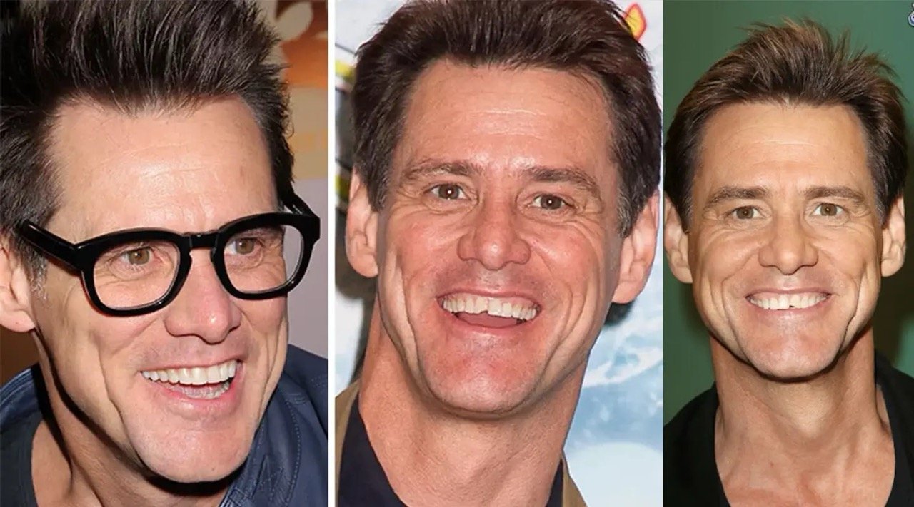 Jim Carrey's Teeth: The Story Behind His Chipped Tooth and Transformation
