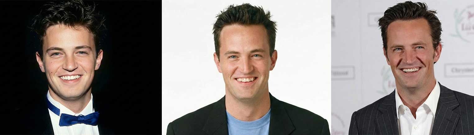 Matthew Perry's Teeth Transformation