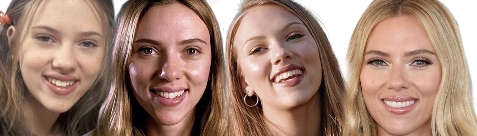 Scarlett Johansson Teeth Veneers And Smile Evolution Guide