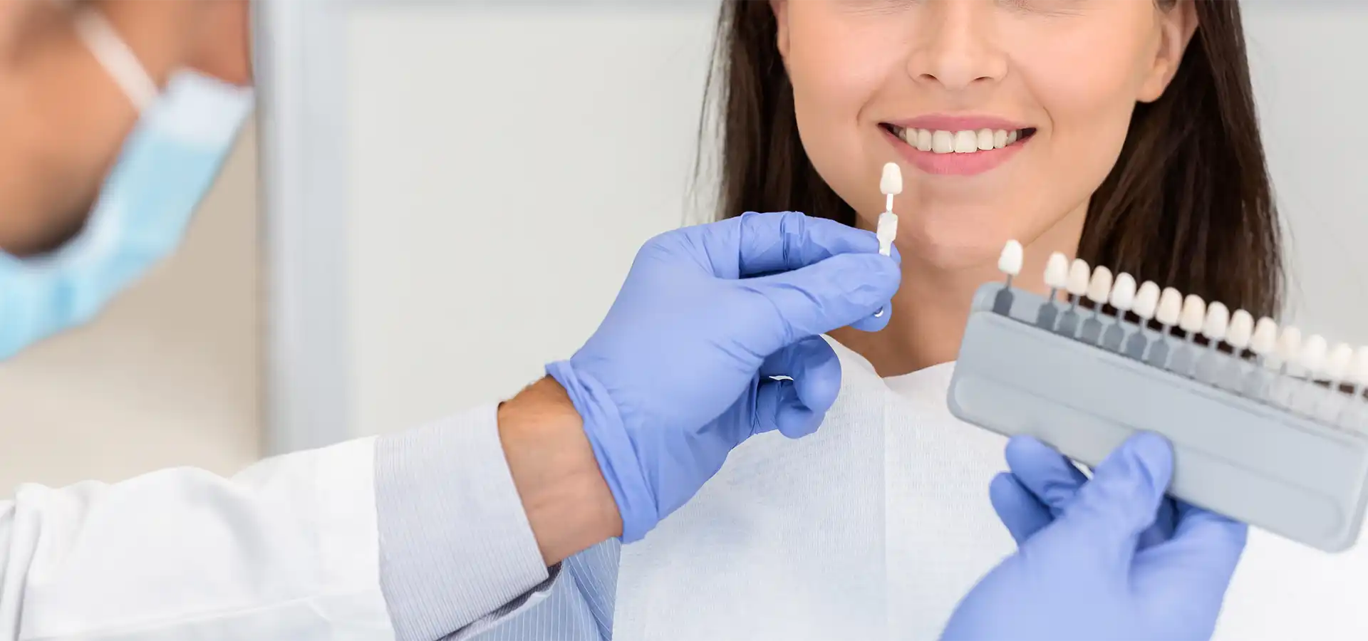 Composite Veneers