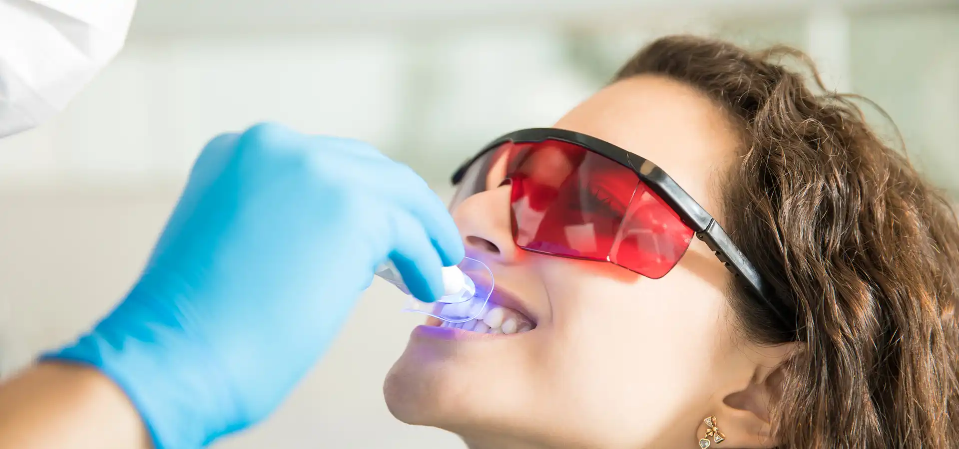 Fluoride Treatment