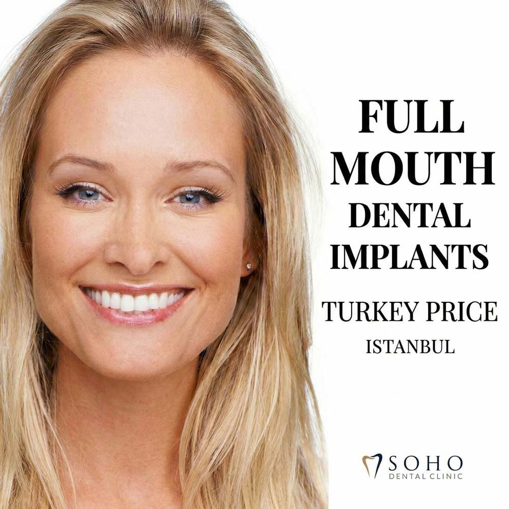 Full Mouth Dental Implants Turkey Price