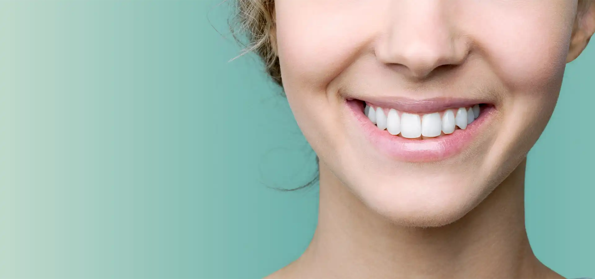 Gummy Smile Treatment in Istanbul, Turkey