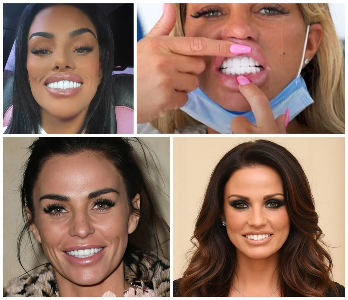 Katie Price Teeth