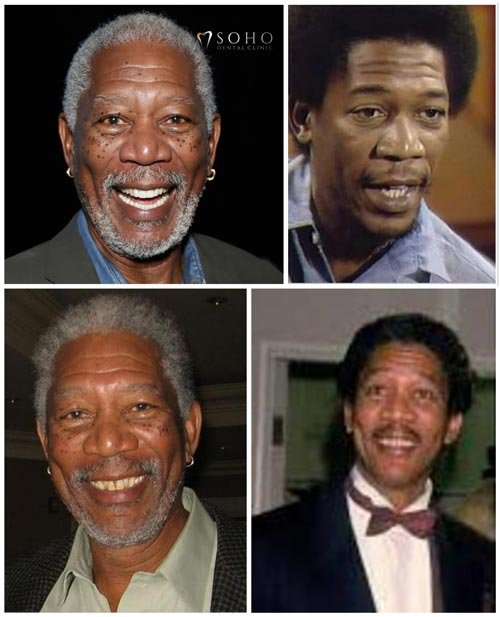 Morgan Freeman’s Smile Evolution