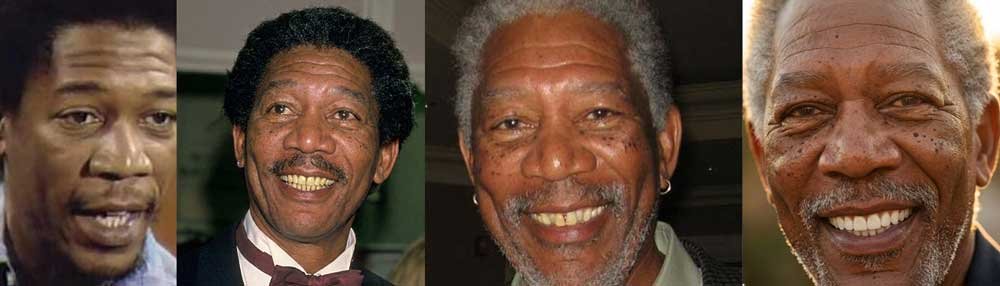Morgan Freeman’s Smile Evolution