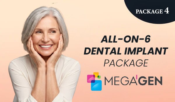 All-on-6 Dental Implant Package – Megagen Implants