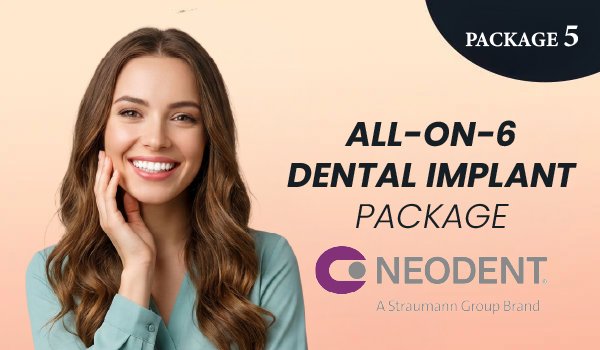 All-on-6 Dental Implant Package – Neodent Implants