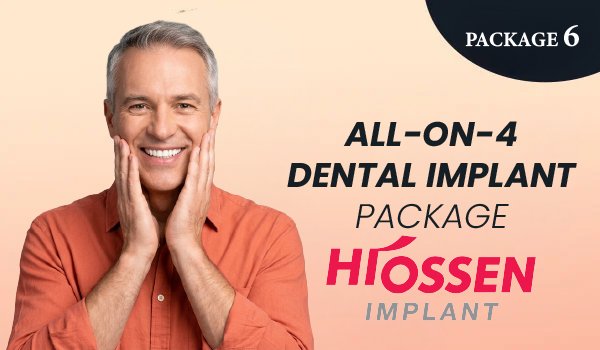 All-on-4 Dental Implant Package – Hiossen Implants