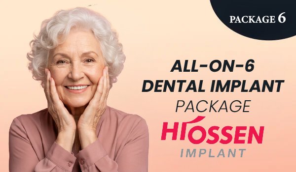 All-on-6 Dental Implant Package – Hiossen Implants