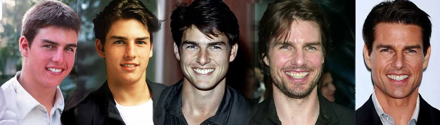 The Story Behind Tom Cruise’s Teeth
