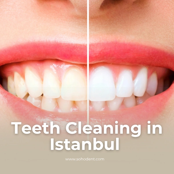 Teeth Cleaning in Istanbul – Complete Guide for International Patients