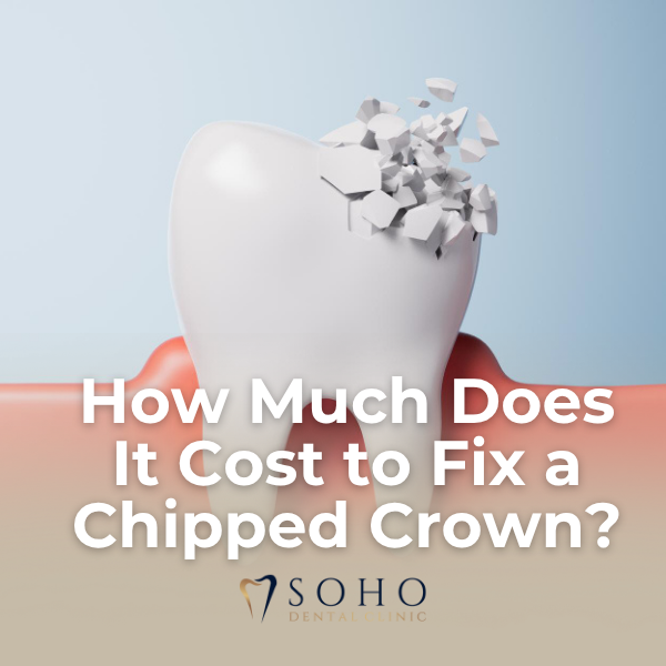 How Much Does It Cost to Fix a Chipped Crown? A Complete Guide