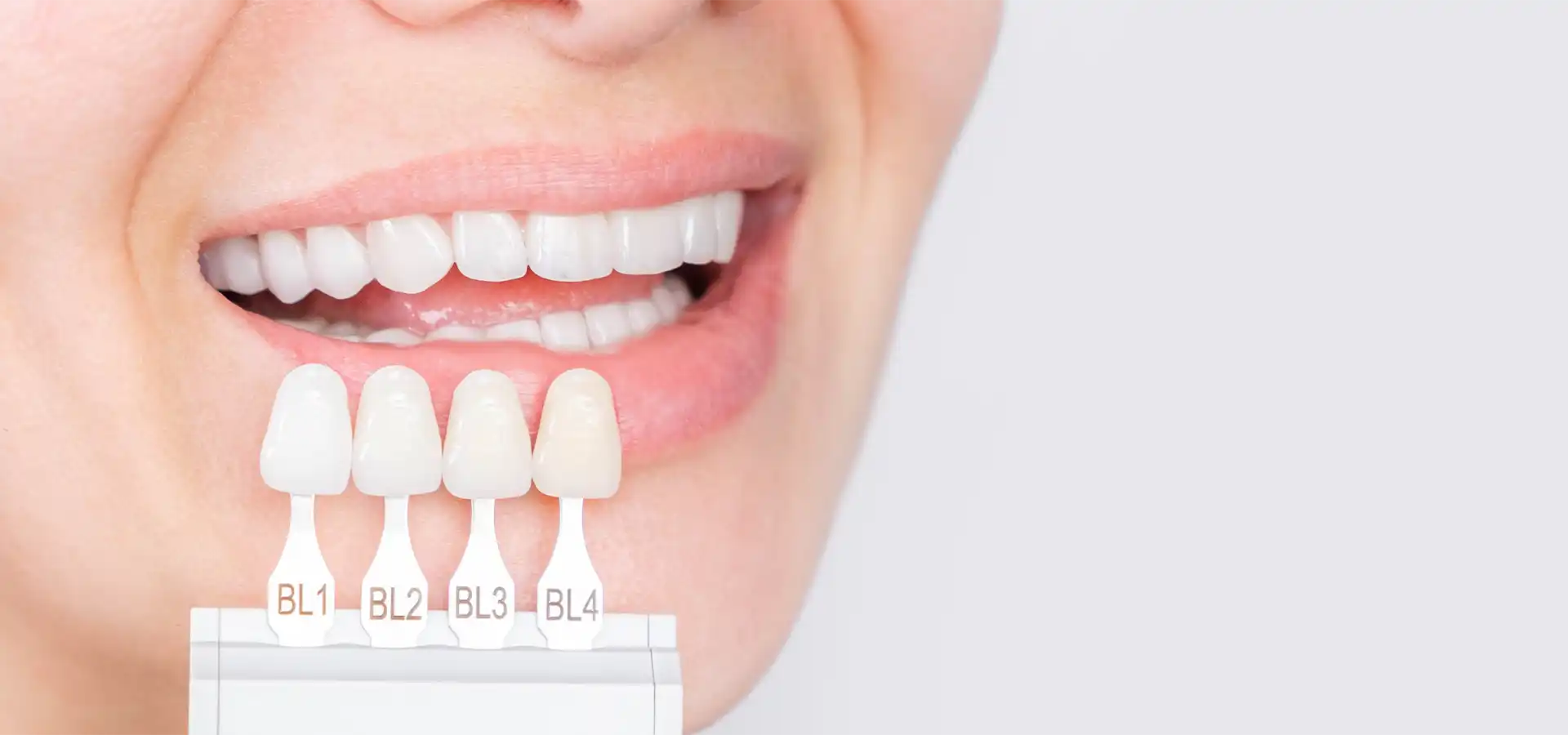 Zirconium Crowns in Istanbul, Turkey