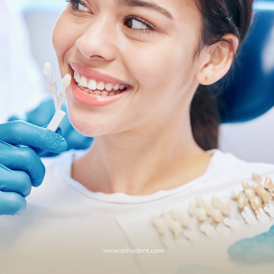 How Are Dental Veneers Applied Step by Step