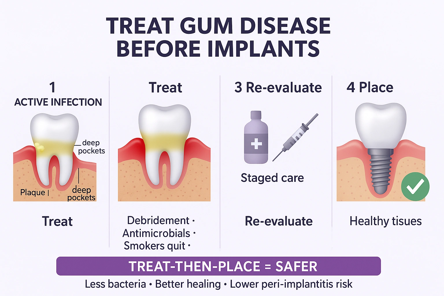 Why Active Gum Disease Must Be Treated First