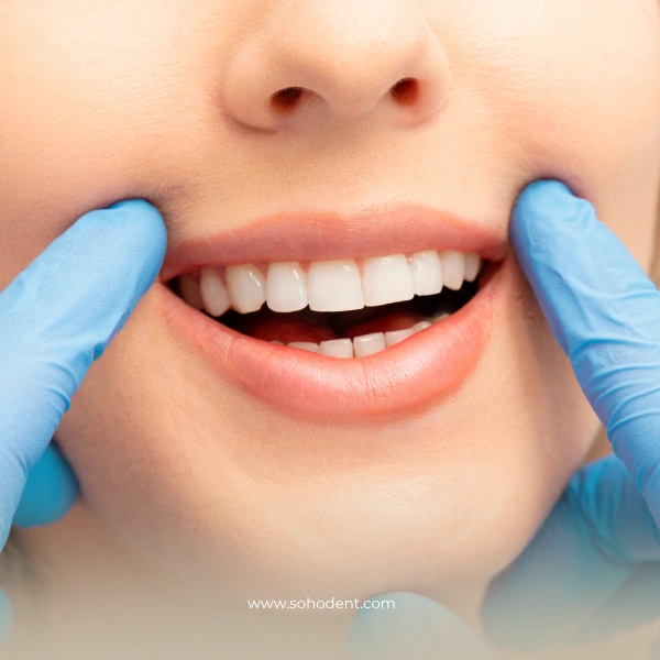 Types of Teeth Cleaning Treatments